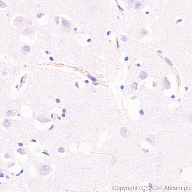 Immunohistochemistry (Formalin/PFA-fixed paraffin-embedded sections) - Anti-MRC2/ENDO180 antibody [EPR29048-78] - BSA and Azide free (AB317749)