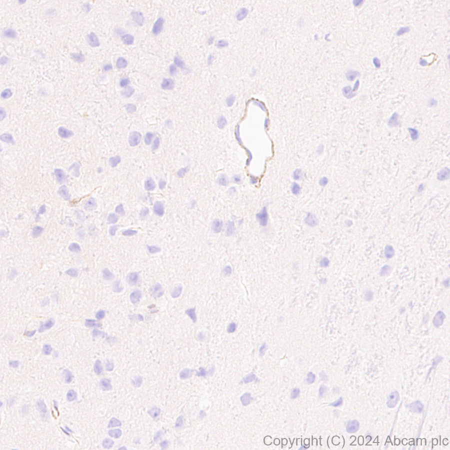 Immunohistochemistry (Formalin/PFA-fixed paraffin-embedded sections) - Anti-MRC2/ENDO180 antibody [EPR29048-78] - BSA and Azide free (ab317749), expandable thumbnail