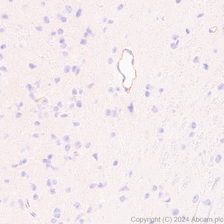 Immunohistochemistry (Formalin/PFA-fixed paraffin-embedded sections) - Anti-MRC2/ENDO180 antibody [EPR29048-78] - BSA and Azide free (AB317749)