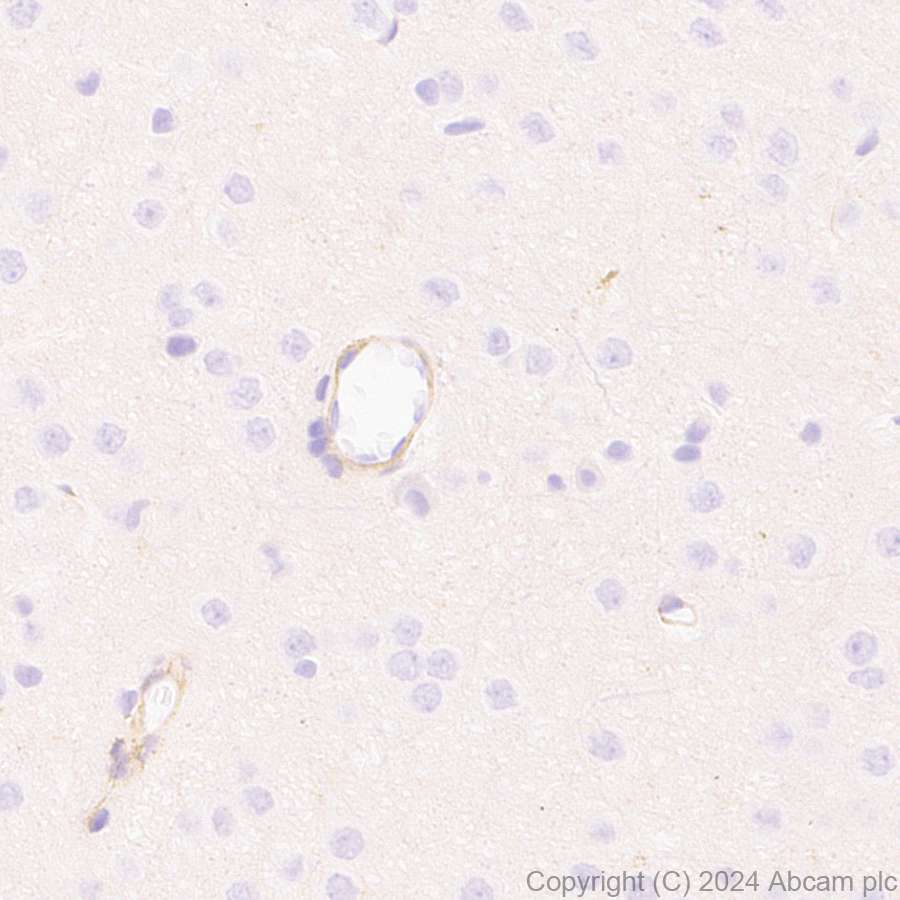 Immunohistochemistry (Formalin/PFA-fixed paraffin-embedded sections) - Anti-MRC2/ENDO180 antibody [EPR29048-78] - BSA and Azide free (AB317749), expandable thumbnail