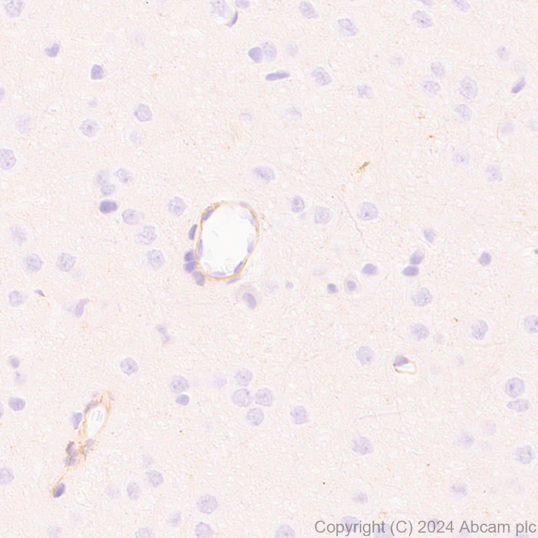 Immunohistochemistry (Formalin/PFA-fixed paraffin-embedded sections) - Anti-MRC2/ENDO180 antibody [EPR29048-78] - BSA and Azide free (AB317749)