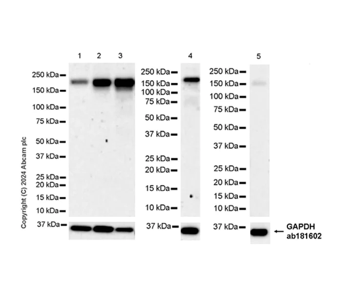 Western blot - Anti-MRC2/ENDO180 antibody [EPR29048-78] - BSA and Azide free (AB317749)