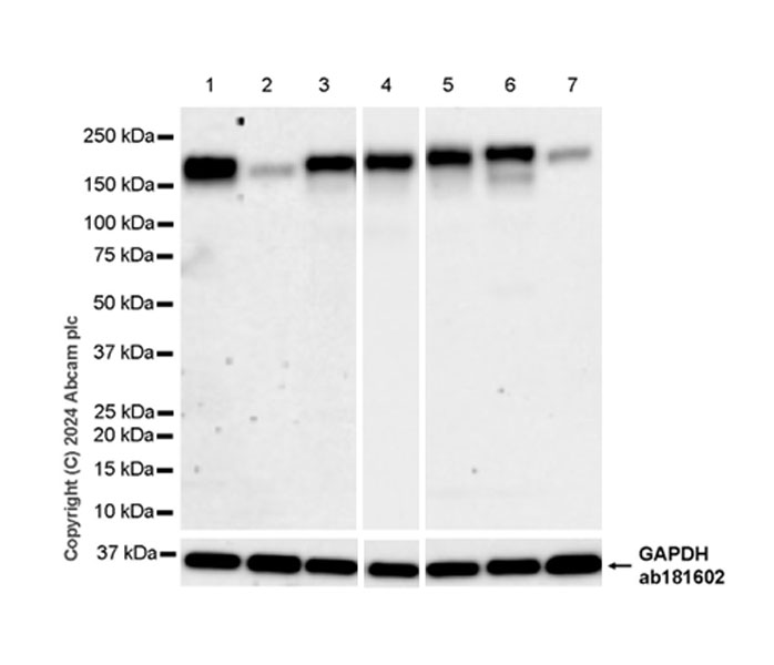 Western blot - Anti-MRC2/ENDO180 antibody [EPR29048-78] - BSA and Azide free (AB317749), expandable thumbnail
