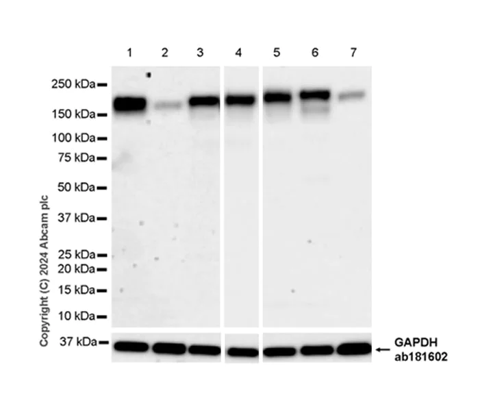 Western blot - Anti-MRC2/ENDO180 antibody [EPR29048-78] - BSA and Azide free (AB317749)