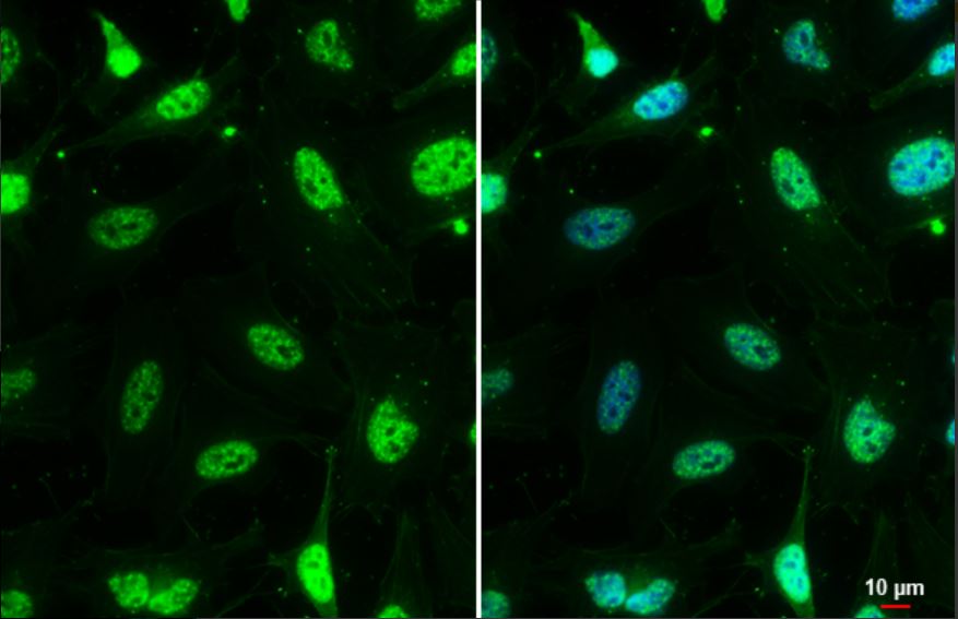 Immunocytochemistry/ Immunofluorescence - Anti-Mre11 antibody [12D7] - BSA and Azide free (AB214), expandable thumbnail