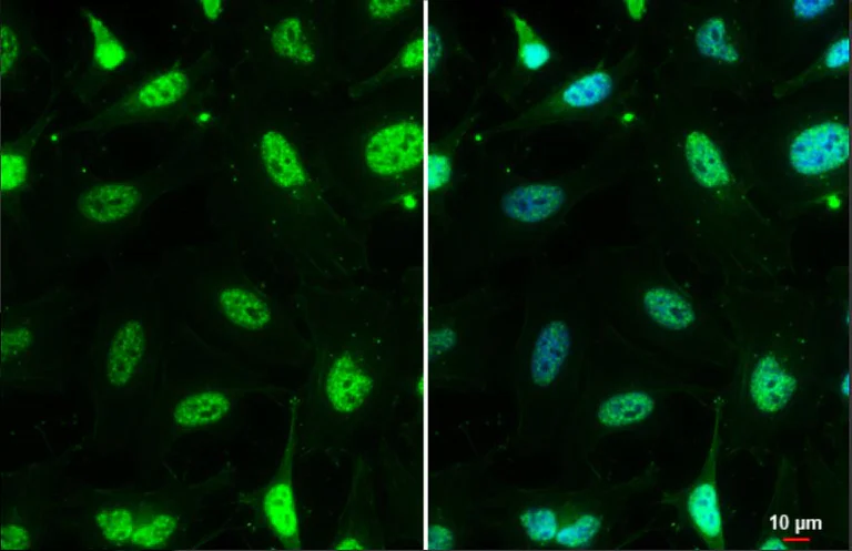 Immunocytochemistry/ Immunofluorescence - Anti-Mre11 antibody [12D7] - BSA and Azide free (AB214)