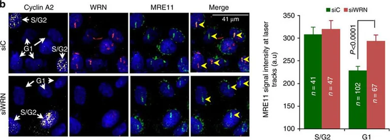 Immunocytochemistry/ Immunofluorescence - Anti-Mre11 antibody [12D7] - BSA and Azide free (AB214)