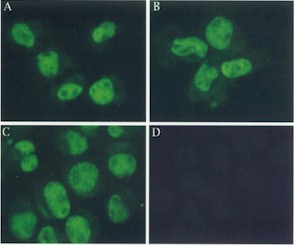 Immunocytochemistry/ Immunofluorescence - Anti-Mre11 antibody [12D7] - BSA and Azide free (AB214), expandable thumbnail