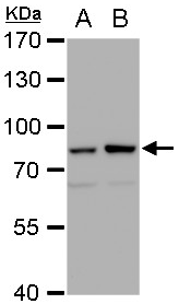 Western blot - Anti-Mre11 antibody [12D7] - BSA and Azide free (AB214), expandable thumbnail