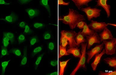 Immunocytochemistry/ Immunofluorescence - Anti-Mre11 antibody (AB154480)