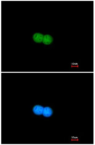 Immunocytochemistry/ Immunofluorescence - Anti-Mre11 antibody (AB154480)