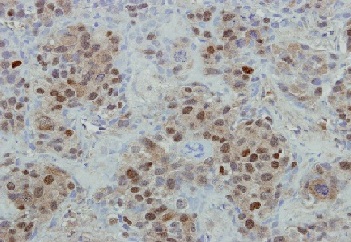 Immunohistochemistry (Formalin/PFA-fixed paraffin-embedded sections) - Anti-Mre11 antibody (AB154480), expandable thumbnail