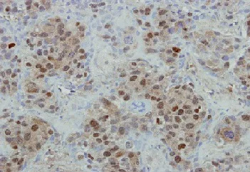 Immunohistochemistry (Formalin/PFA-fixed paraffin-embedded sections) - Anti-Mre11 antibody (AB154480)