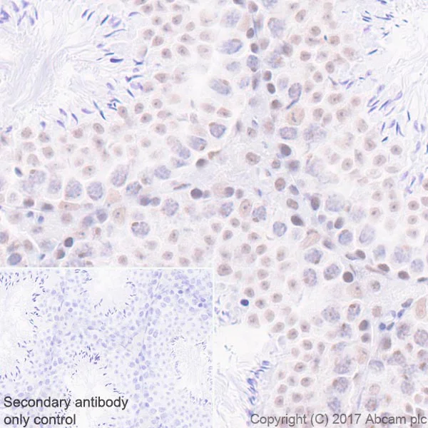 Immunohistochemistry (Formalin/PFA-fixed paraffin-embedded sections) - Anti-Mre11 antibody [EPR21027] - ChIP Grade (AB208020)