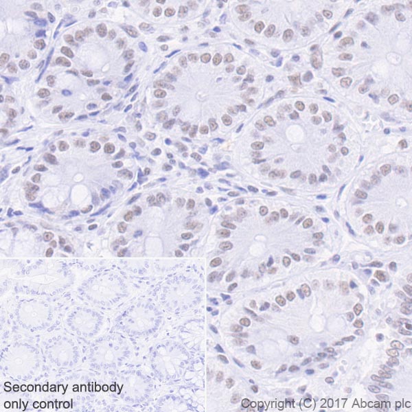 Immunohistochemistry (Formalin/PFA-fixed paraffin-embedded sections) - Anti-Mre11 antibody [EPR21027] - ChIP Grade (ab208020), expandable thumbnail