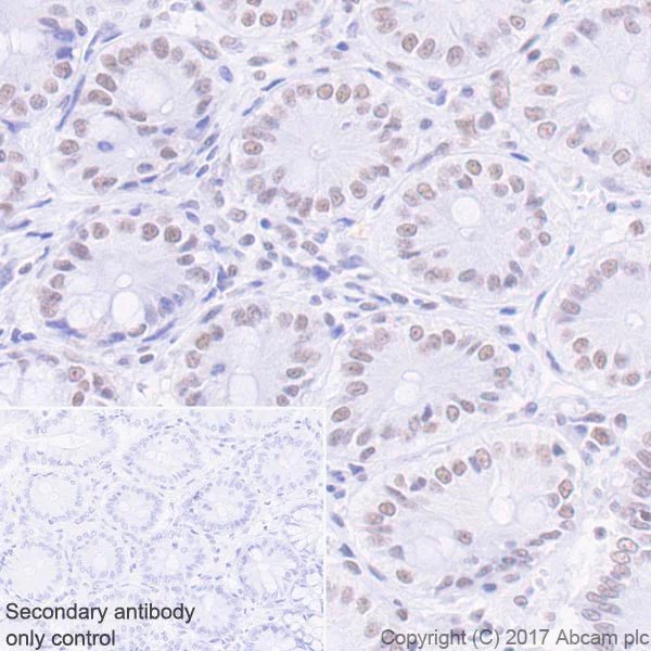 Immunohistochemistry (Formalin/PFA-fixed paraffin-embedded sections) - Anti-Mre11 antibody [EPR21027] - ChIP Grade (AB208020)