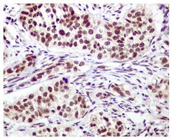 Immunohistochemistry (Formalin/PFA-fixed paraffin-embedded sections) - Anti-Mre11 antibody [EPR3471] (AB109623)