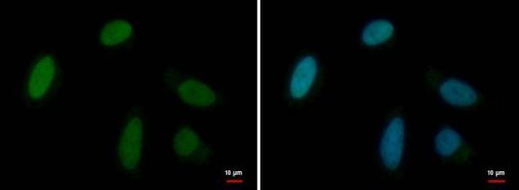 Immunocytochemistry/ Immunofluorescence - Anti-MRG15 antibody (AB183663), expandable thumbnail