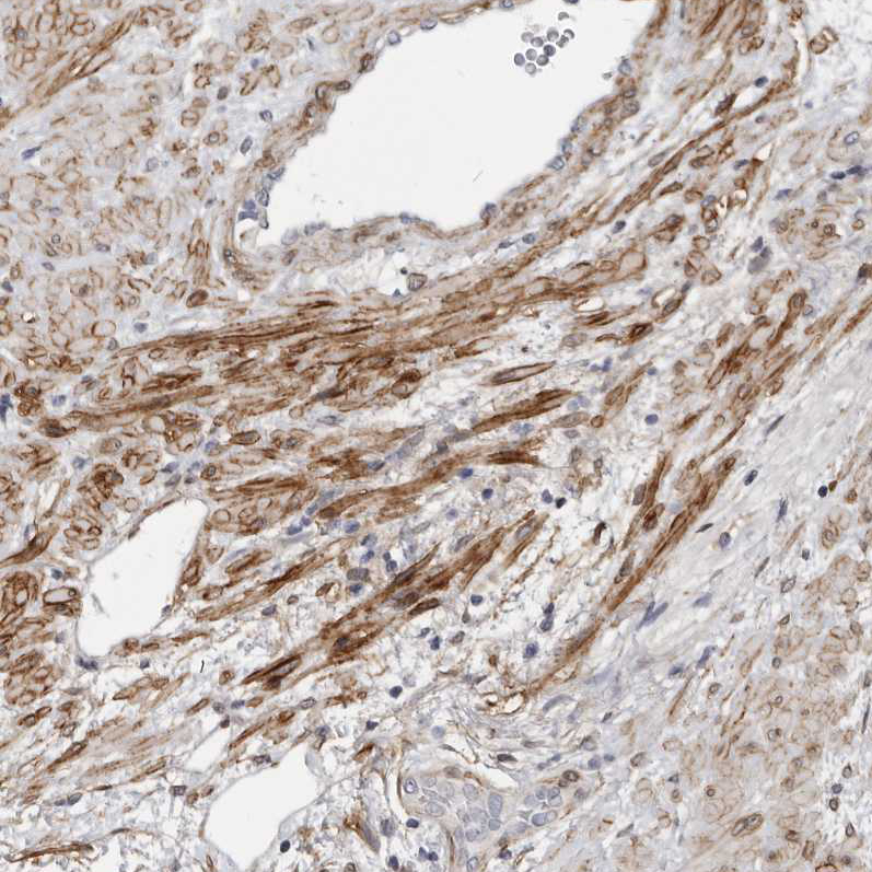 Immunohistochemistry (Formalin/PFA-fixed paraffin-embedded sections) - Anti-MRGPRF antibody (AB254756), expandable thumbnail