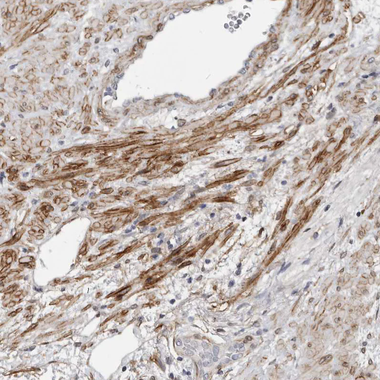 Immunohistochemistry (Formalin/PFA-fixed paraffin-embedded sections) - Anti-MRGPRF antibody (AB254756)