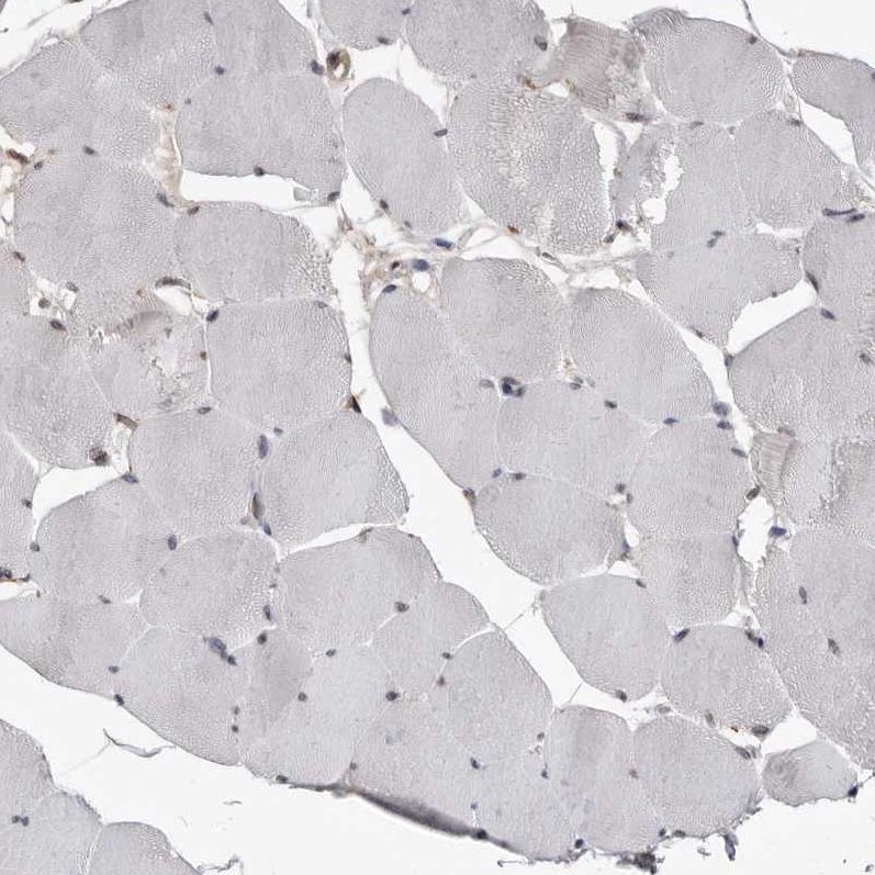 Immunohistochemistry (Formalin/PFA-fixed paraffin-embedded sections) - Anti-MRGPRF antibody (ab254756), expandable thumbnail