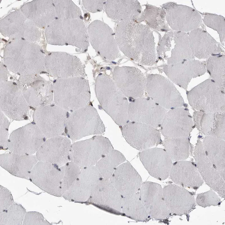 Immunohistochemistry (Formalin/PFA-fixed paraffin-embedded sections) - Anti-MRGPRF antibody (AB254756)