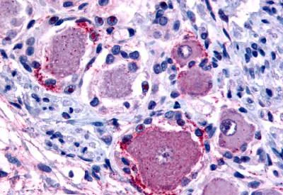 Immunohistochemistry (Formalin/PFA-fixed paraffin-embedded sections) - Anti-MRGPRX4 antibody - C-terminal (AB188740)