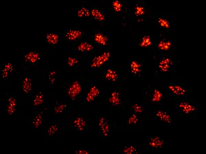 Immunocytochemistry/ Immunofluorescence - Anti-MRGX antibody [EPR9775(2)] (AB178405)