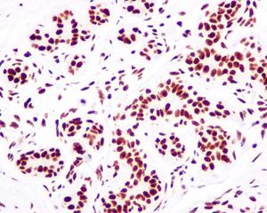 Immunohistochemistry (Formalin/PFA-fixed paraffin-embedded sections) - Anti-MRGX antibody [EPR9775(2)] (AB178405), expandable thumbnail