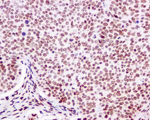 Immunohistochemistry (Formalin/PFA-fixed paraffin-embedded sections) - Anti-MRGX antibody [EPR9775(2)] - BSA and Azide free (AB250034)