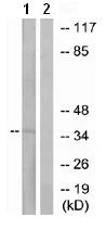 Western blot - Anti-MRGX1 antibody (AB77519)
