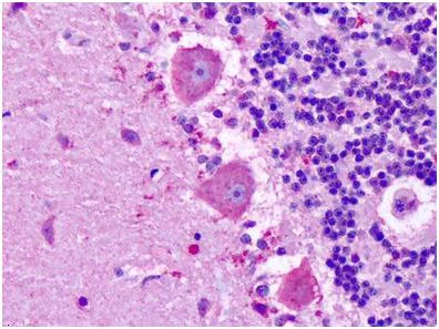 Immunohistochemistry (Formalin/PFA-fixed paraffin-embedded sections) - Anti-MRGX3 antibody - Extracellular domain (AB140863)