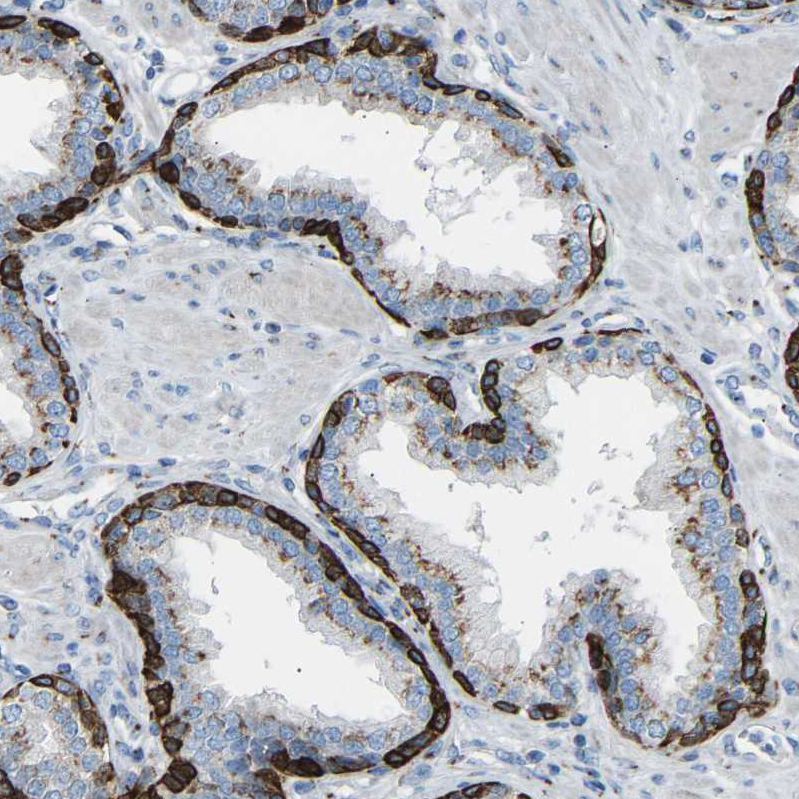 Immunohistochemistry (Formalin/PFA-fixed paraffin-embedded sections) - Anti-MRI antibody (AB246926), expandable thumbnail