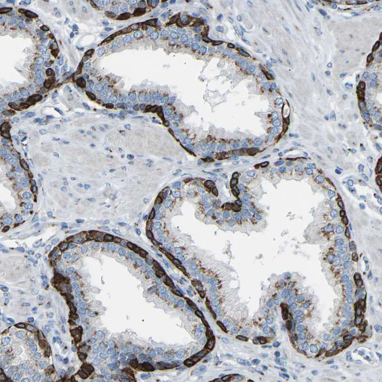 Immunohistochemistry (Formalin/PFA-fixed paraffin-embedded sections) - Anti-MRI antibody (AB246926)
