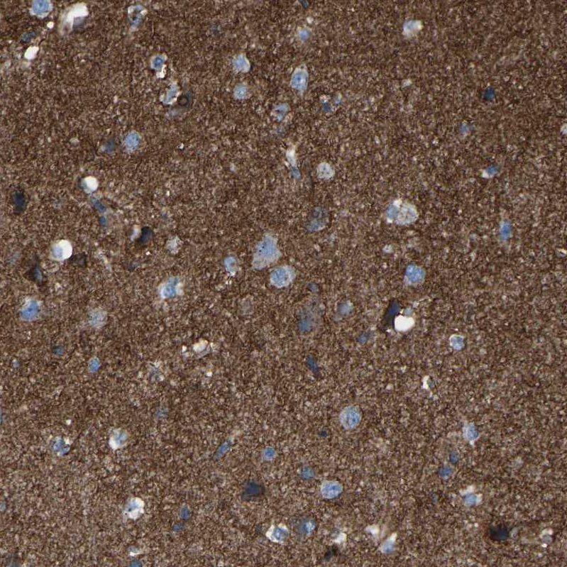 Immunohistochemistry (Formalin/PFA-fixed paraffin-embedded sections) - Anti-MRI antibody (AB246926), expandable thumbnail