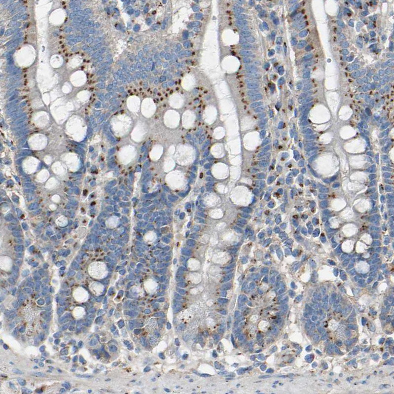 Immunohistochemistry (Formalin/PFA-fixed paraffin-embedded sections) - Anti-MRI antibody (AB246926), expandable thumbnail