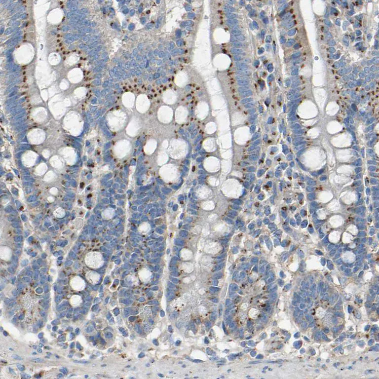 Immunohistochemistry (Formalin/PFA-fixed paraffin-embedded sections) - Anti-MRI antibody (AB246926)