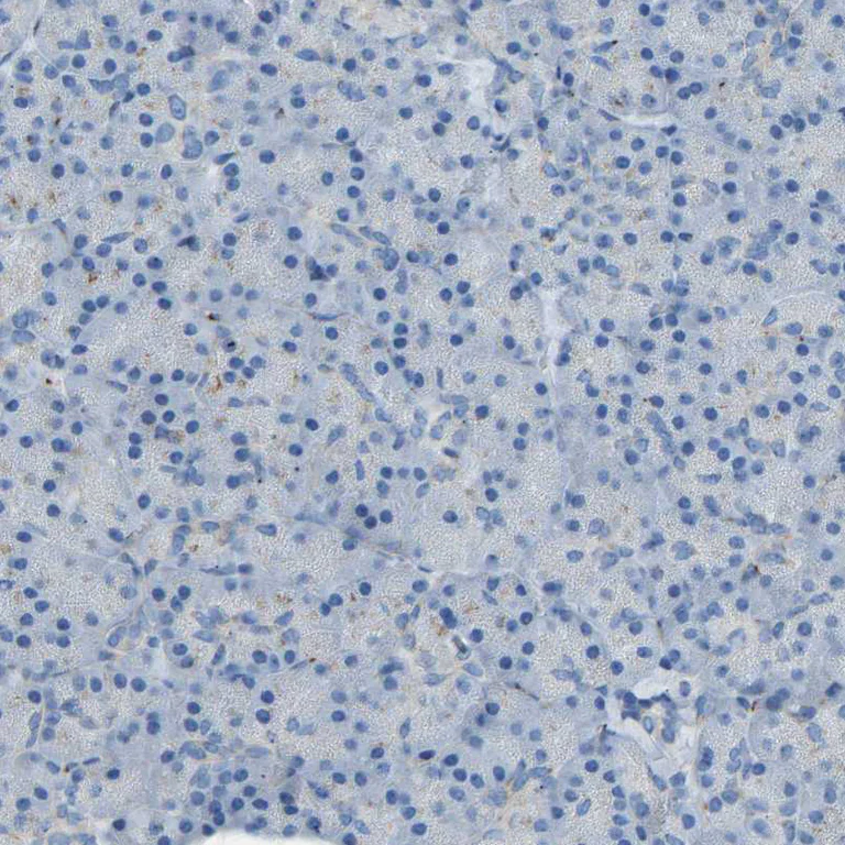 Immunohistochemistry (Formalin/PFA-fixed paraffin-embedded sections) - Anti-MRI antibody (AB246926)
