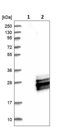 Western blot - Anti-MRI antibody (AB246926), expandable thumbnail
