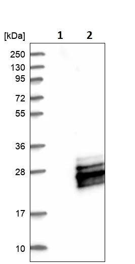 Western blot - Anti-MRI antibody (AB246926)