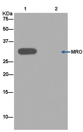 Immunoprecipitation - Anti-MRO antibody [EPR12158] (AB181048), expandable thumbnail