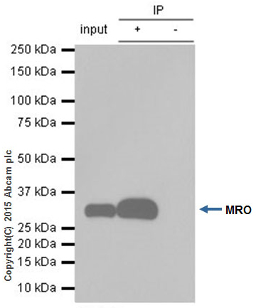 Immunoprecipitation - Anti-MRO antibody [EPR12158] (AB181048), expandable thumbnail
