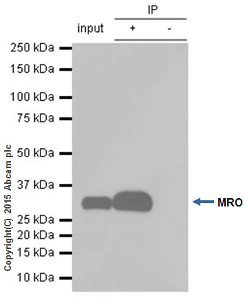 Immunoprecipitation - Anti-MRO antibody [EPR12158] (AB181048)
