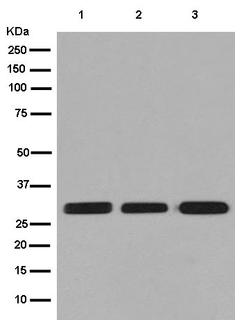 Western blot - Anti-MRO antibody [EPR12158] (ab181048), expandable thumbnail
