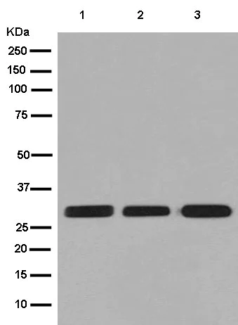 Western blot - Anti-MRO antibody [EPR12158] (AB181048)