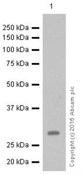 Western blot - Anti-MRO antibody [EPR12158] (AB181048), expandable thumbnail
