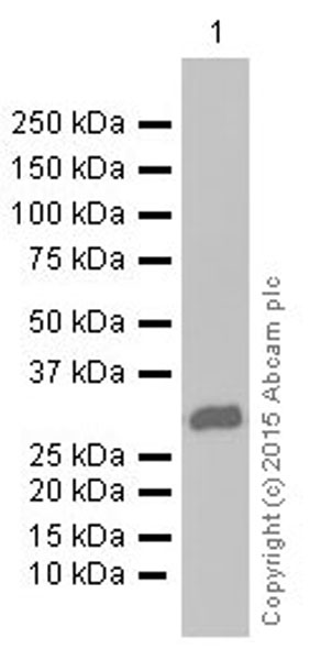 Western blot - Anti-MRO antibody [EPR12158] (AB181048), expandable thumbnail