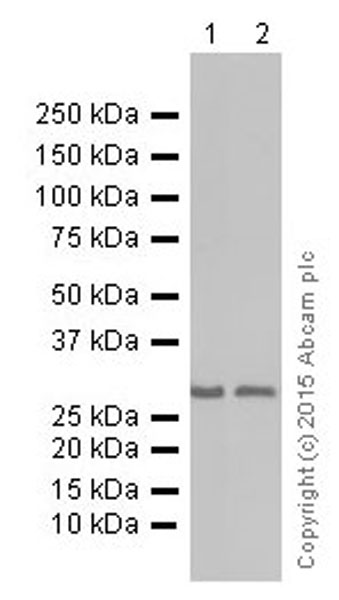 Western blot - Anti-MRO antibody [EPR12158] (AB181048), expandable thumbnail