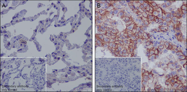 Immunohistochemistry (Formalin/PFA-fixed paraffin-embedded sections) - Anti-MRP1 antibody [EPR21061] (AB230948), expandable thumbnail