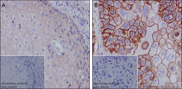 Immunohistochemistry (Formalin/PFA-fixed paraffin-embedded sections) - Anti-MRP1 antibody [EPR21061] (AB230948), expandable thumbnail